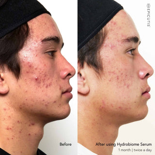 Epicutis Hydrobiome Serum