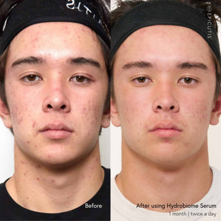 Epicutis Hydrobiome Serum