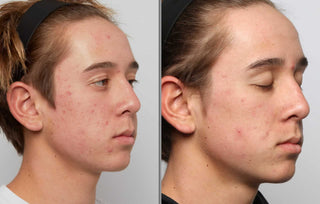 Epicutis Hydrobiome Serum